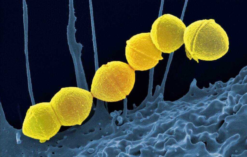 Turicibacter